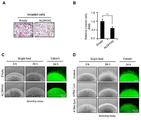 ALDH1A2 Is a Candidate Tumor Suppressor Gene in Ovarian Cancer