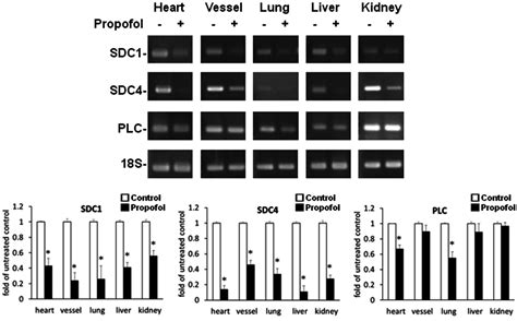 Image result for Propofol Overdose