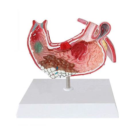 Image result for Digestive Model Tutorial