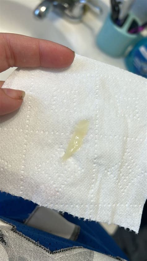 Egg White Discharge Late In Cycle at Bernadette Oakman blog