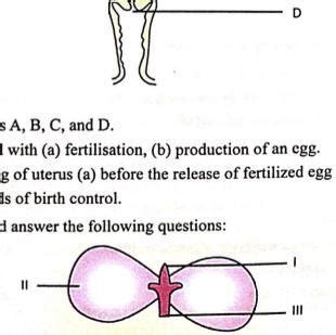 Pls answer thank you so much - Brainly.in