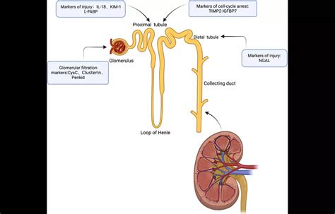 Angiotensinogen as a Predictive Biomarker for AKI and CKD After AMI: Study