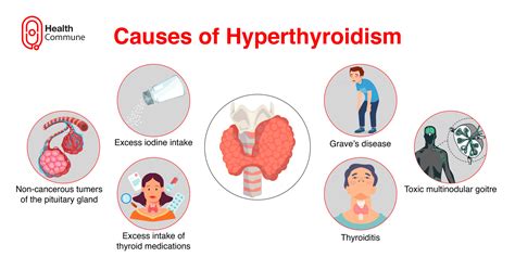 Image result for hyperthyroidism