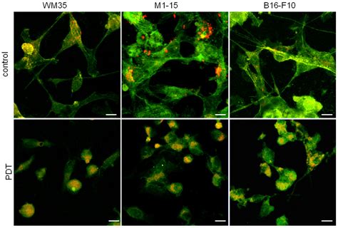 Inhibition of Survival Mechanisms and Cell Death Induction in Melanoma ...
