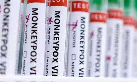 పురుషులతో పురుషుల లైంగిక సంబంధాలే మంకీపాక్స్ వ్యాప్తికి కార‌ణం ...