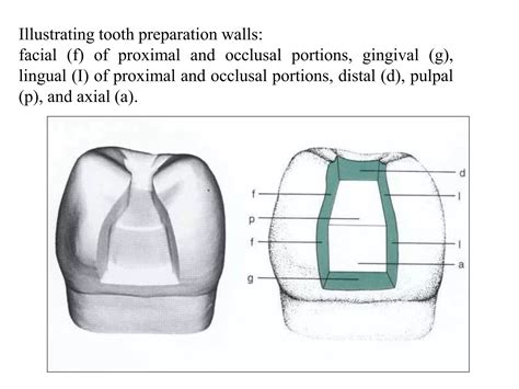 Class 2 amalgam restoration | PPTX
