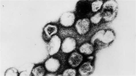 Bildergebnis für rubella virus