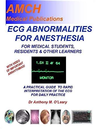 ECG ABNORMALITIES FOR ANESTHESIA: A practical guide to rapid ...