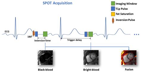 SPOT-Cardio: Integrated Application for AI-Powered Automated Myocardial ...