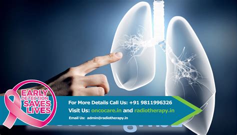 Doctor for Cancer in Delhi, India, Radiation Treatment for Cancer in India.