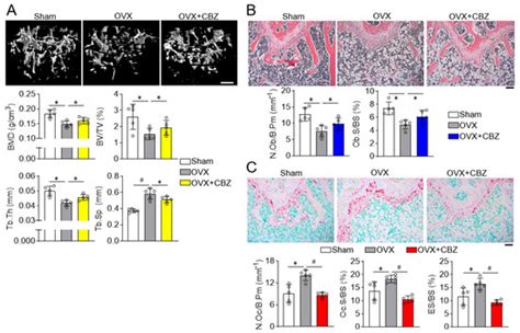 Cabozantinib, an Anti-Aging Agent, Prevents Bone Loss in Estrogen ...