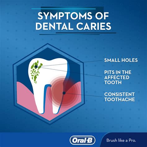 Types Of Dental Caries Treatments at Marie Vaughan blog