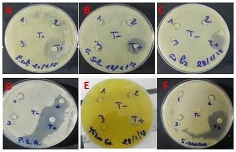 Mitigation of Hepatic Impairment with Polysaccharides from Red Alga ...