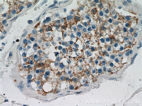 BZW1 antibody (19917-1-AP) | Proteintech