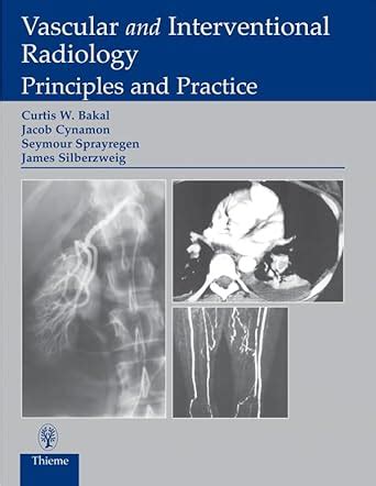 Vascular and Interventional Radiology: Principles and Practice eBook ...