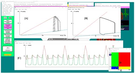 Modelling and Simulation of the Combined Use of IABP and Impella as a ...