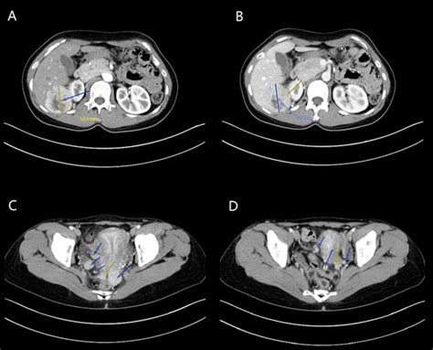 Diagnostics | Special Issue : Diagnosis in Obstetrics and Gynecology