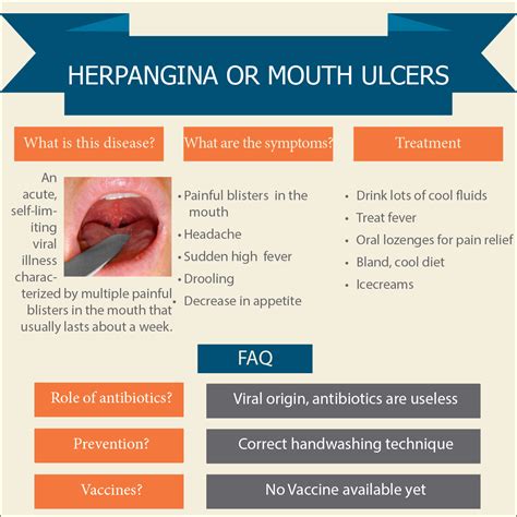 Herpangina or Painful Mouth Ulcers - Nathani Clinic