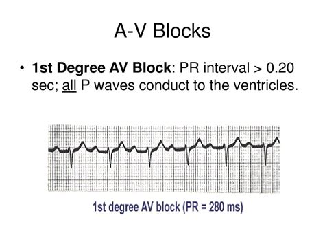 Image result for ACLS Post Cardiac Algorithm