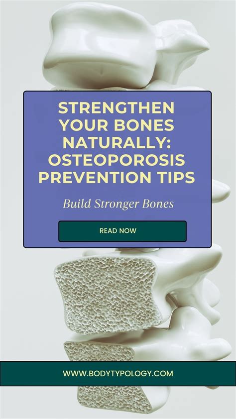 Natural osteoporosis treatment guidelines – Artofit