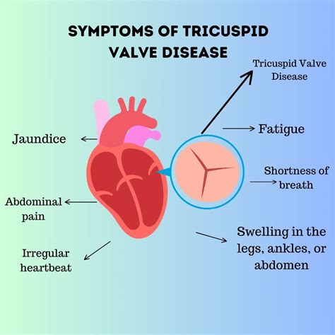 Tricuspid valve disease: Causes, Risk Factors, Symptoms, Treatment