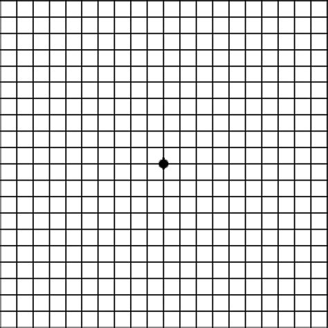Macular degeneration - Age related, Causes, Types, Symptoms, Treatment