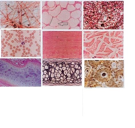 Connective Tissue Tutorial 的图像结果