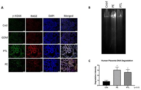 A Role for RAGE in DNA Double Strand Breaks (DSBs) Detected in ...