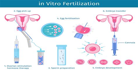 IVF Process Step by Step 的图像结果