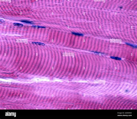 Image result for Muscle Fiber Z-Line