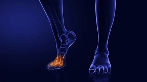 Ball of Foot Pain Running 的图像结果