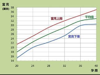 孕34周只听“砰”一声羊水早破！结果：医生给出破水理由哭笑不得_胎儿