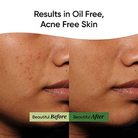 Buy Dot & Key Pollution & Acne Defense Green Clay Mask — Vanity Wagon