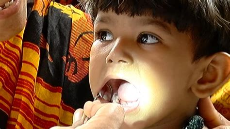 Study finds eight in ten children in India suffer from oral health ...