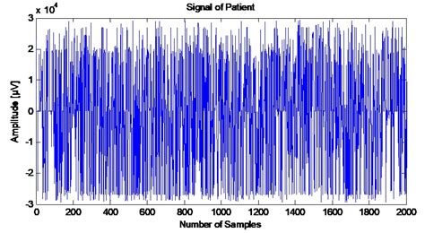 Diagnosing Depression: Egged on by EEG – STEAMindiaReports