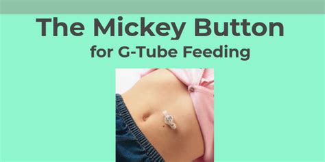 Image result for Mickey Button Procedure