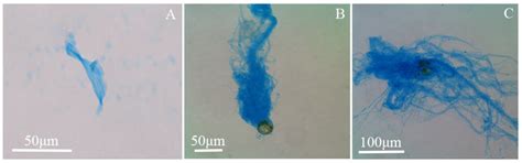 Effects of Temperature on Transparent Exopolymer Particle Production ...