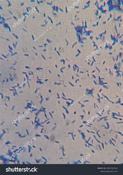 Stained Bacteria Bacilli Under Microscope Stock Photo 2052761516 ...