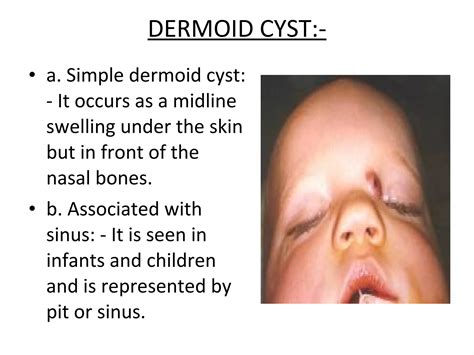 Diseases of external nose | PPT
