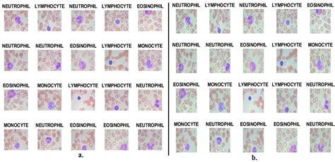 Basophils Neutrophils Lymphocytes Monocytes Eosinophils