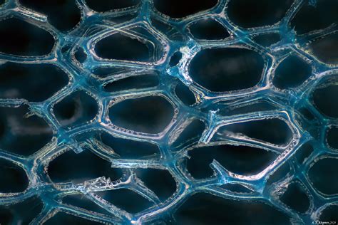 12 Microscopic structure ideas | microscopic, things under a microscope ...