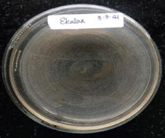 Enhanced quinalphos degradation using immobilized cells of Enterobacter ...