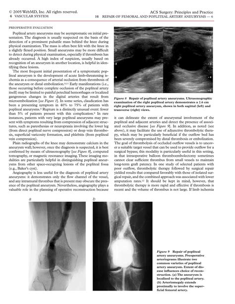 Acs0616 Repair Of Femoral And Popliteal Artery Aneurysms | PDF