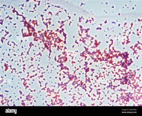 Gram Stain Staphylococcus Aureus