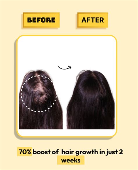 Roopayur Biotin Capsules for Hair Growth & Strength | ROOPAYUR