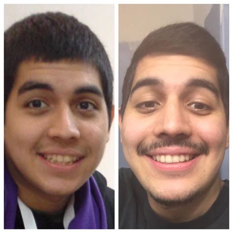 I Got Braces at 60 Years Old, and My Smile’s Never Looked Better HD Wallpaper