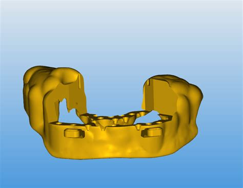 Image result for Stackable Guide Dailymotion