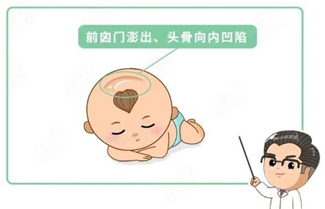 什么是宝宝头颅畸形？ - 知乎