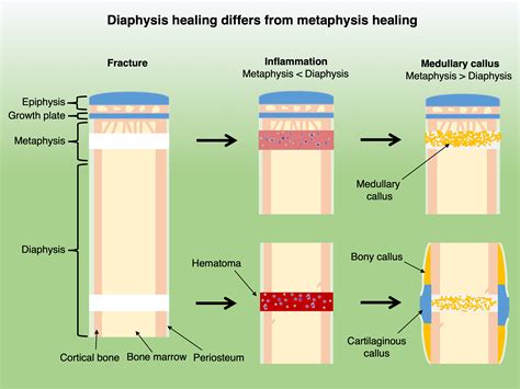 Intramembranous Ossification Stages