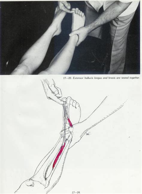 How to Muscle Test Lumbar Extensor Muscles 的图像结果